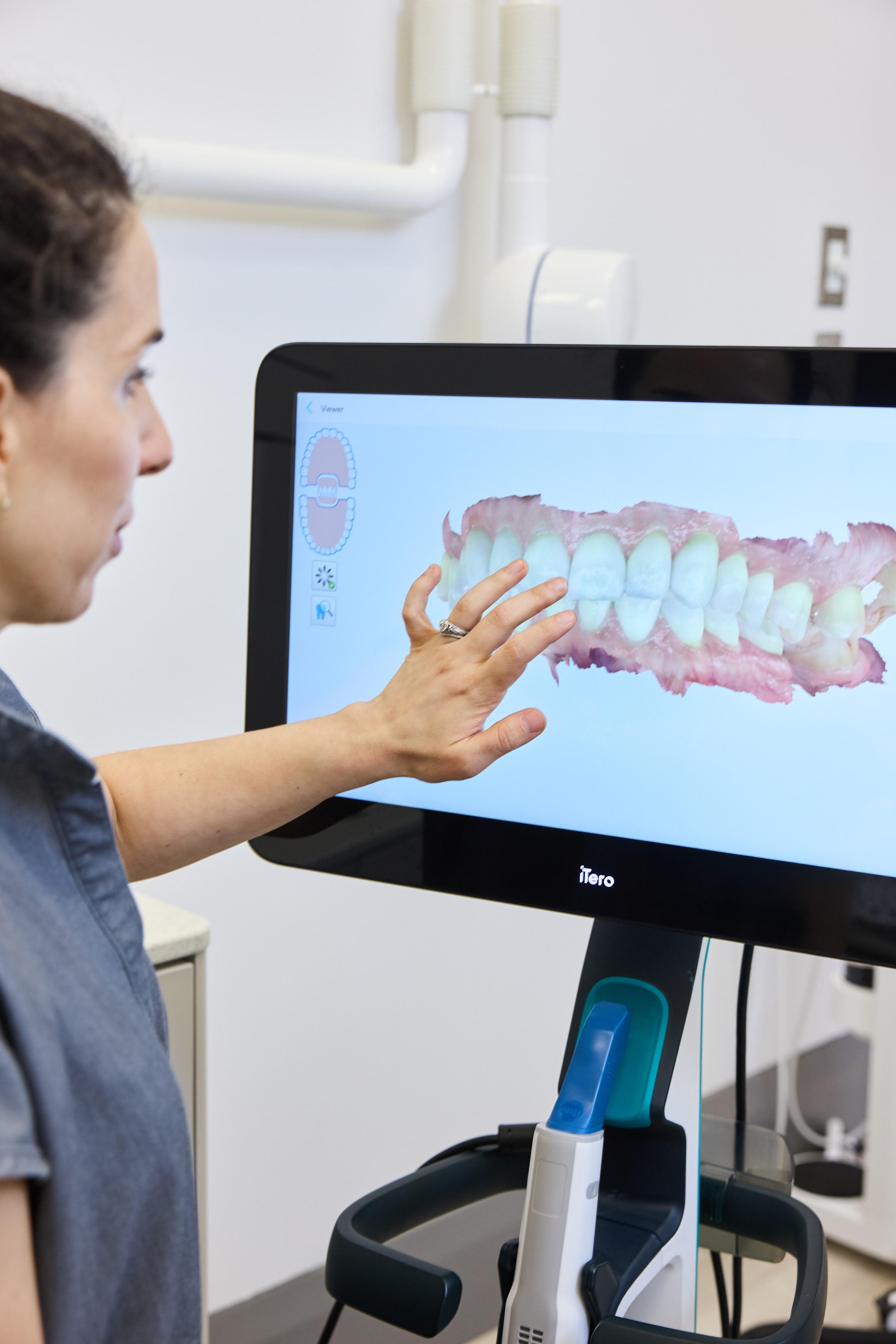 Dr. Liana Guberman reviewing a 3D digital scan of teeth on an iTero scanner